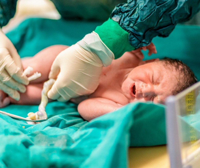 Owinięcie pępowiną a zdrowe dziecko Owinięcie pępowiną a zdrowe dziecko